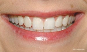 close up of a woman before dental treatment
