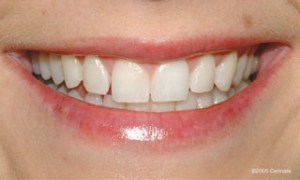 close up of a woman before dental treatment