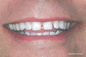 close up of a man before dental treatment