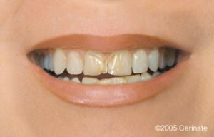 close up of a woman before dental procedure